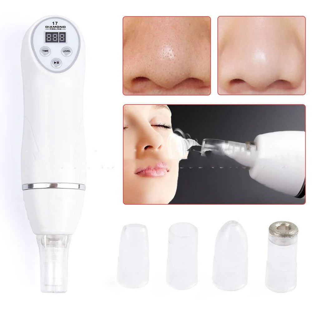 Blackhead Remover
